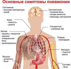 О пневмонии и мерах ее профилактики.