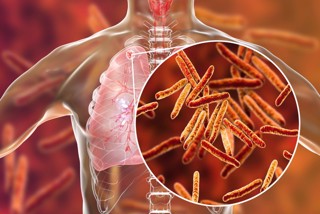 Профилактика туберкулеза, особенности проявления болезни, пути передачи и меры борьбы с этой инфекцией.