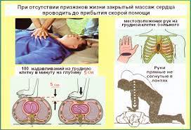 Действия населения при неотложных состояниях