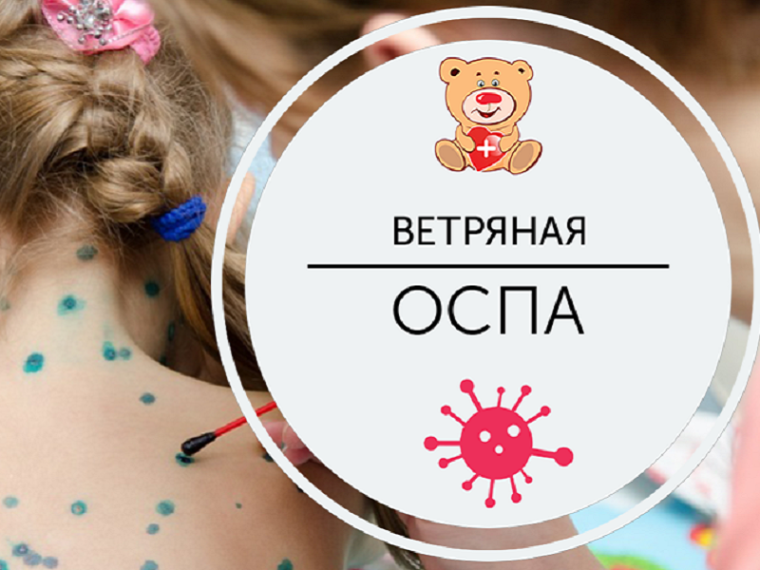 Профилактика ветряной оспы