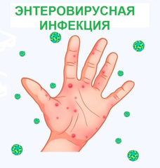 Профилактики энтеровирусных инфекций.